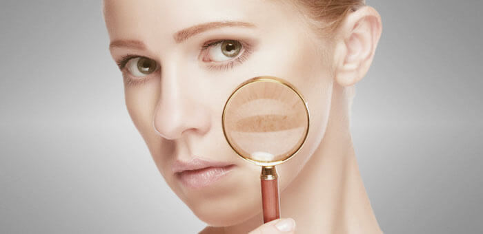 Smartbeauty: soluciones inteligentes para los efectos estéticos de un estilo de vida hiperconectado